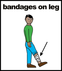Bandages on leg