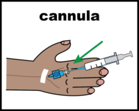 Cannula (medicine going in)