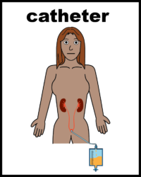 Catheter V2