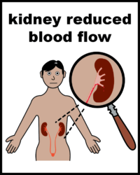 Kidney reduced blood flow