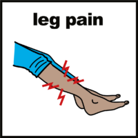 Pain in leg
