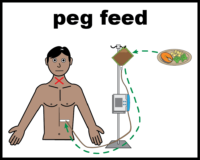 Peg feed