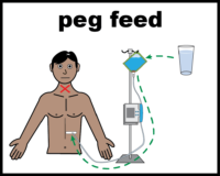 Peg feed fluids