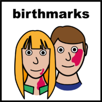 birthmarks