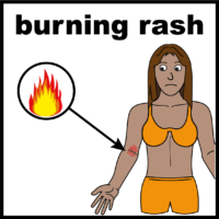 burning rash