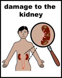 damage to the kidney
