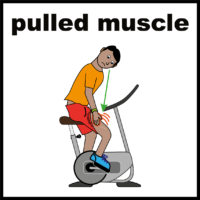 exercise pulled muscle