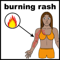 burning rash V2
