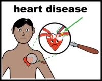 heart disease