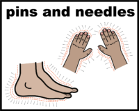 pain pins and needles V2