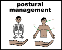 postural management V2