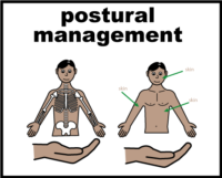 postural management V3