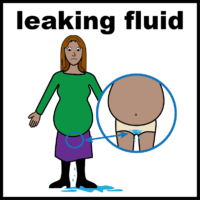 pregnant leaking fluid V2