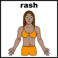 rash V3
