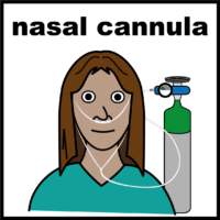 nasal cannula