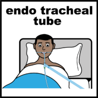 endo tracheal tube V2
