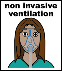 Non invasive ventilation NIV V2