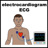 electrocardiogram ECG