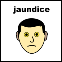 jaundice V2