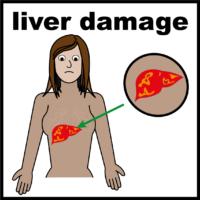 liver damage V2