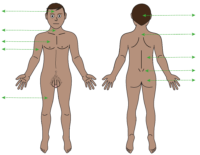 male body map with arrows