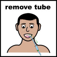 remove tube