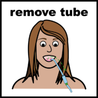 remove tube V2
