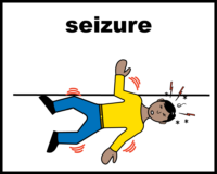 seizure