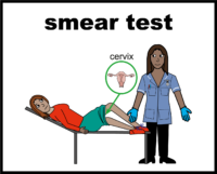 smear test