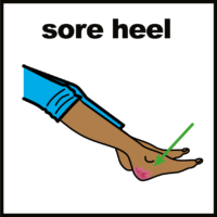 sore heel