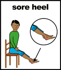 sore heel V2