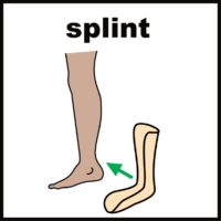 splint