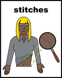 stitches