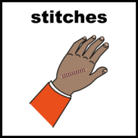stitches on hand
