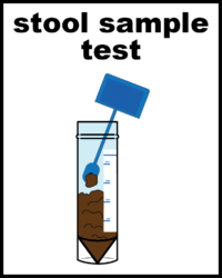 stool sample test