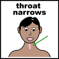 throat gets too narrow V2
