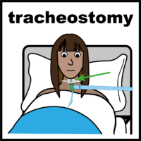 tracheostomy