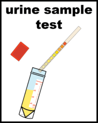 urine sample test