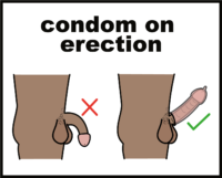 condom on erection