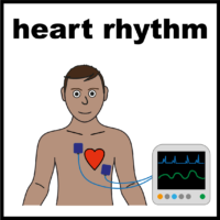 heart rhythm on a machine