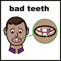 bad teeth