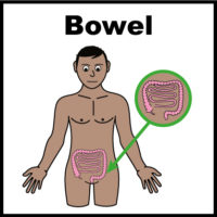 Thumbnail for Irritable bowel syndrome (IBS)