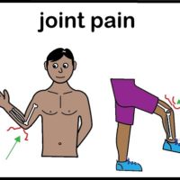 Thumbnail for Joint pain