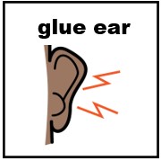 Thumbnail for Glue ear