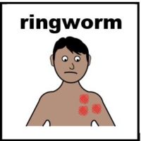Thumbnail for Ringworm 