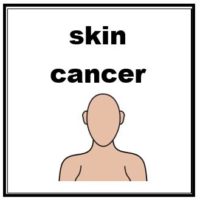 Thumbnail for Skin cancer