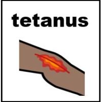 Thumbnail for Tetanus 