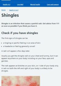 Thumbnail for Shingles