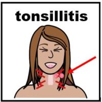 Thumbnail for Tonsillitis