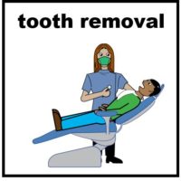 Thumbnail for Tooth removal